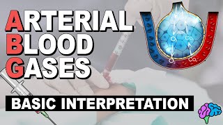 Basic ABG Interpretation  Arterial Blood Gases Part 3 [upl. by Ydaj709]