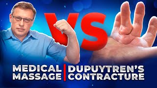 How to Treat Dupuytrens Contracture at Home  Homework For Patience [upl. by Ahkihs]