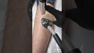 tattoo removal [upl. by Manara]