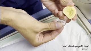 part 1palatal lift prosthesis palatopharyngeal incompetence dr Ahmed tebah University Medina [upl. by Kirre]