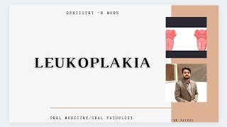 LEUKOPLAKIA [upl. by Einohtna]