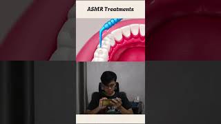 ASMR Treating cavities asmrtreatment asmr [upl. by Base218]