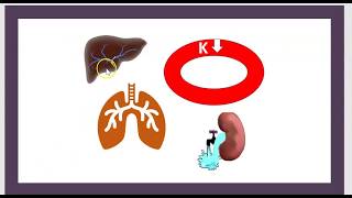 3 Minutes Acidocétose Diabète Acidose Cétoacidose Causes Symptômes Traitement CDA HHNS [upl. by Blood]