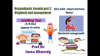 megaloblastic anemia part 2 Diagnosis treatment [upl. by Wing]