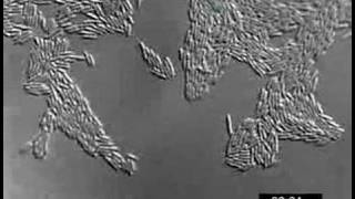 Pseudomonas aeruginosa twitching motility YFPPilU [upl. by Wiltshire]