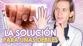 UÑAS DÉBILES Causas y soluciones reales  COMO SOLUCIONARLAS  Simon Scarano Dermatólogo [upl. by Levins]