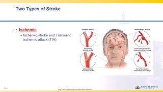 Ischemic Stroke  Lisa Klein [upl. by Polivy]