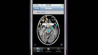 eAnatomy pour iPhone [upl. by Chrysler]