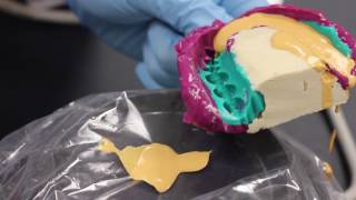 Alginate Impression for custom tray [upl. by Trill]