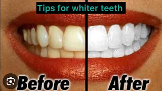 “ Don’t miss thisinexpensive whiter teeth “ [upl. by Ainaznat]