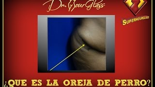 Abdominoplastia orejas de perro por el Dr Curvas Houston Austin Dallas San Antonio [upl. by Enaitsirk]