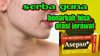 Benarkah sabun asepso bisa untuk jerawat Review sabun asepso [upl. by Hilten]