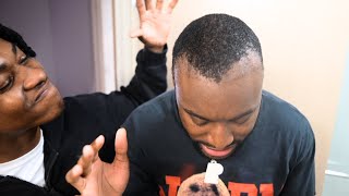 My Family DESTROYED My Hairline Surgery [upl. by Eenahc215]