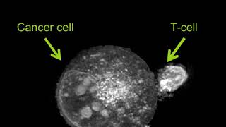 Labelfree Live Cell Imaging Activated TCell Killing Cancer Cell [upl. by Varin8]