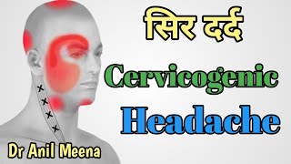 cervicogenic headache exercises in hindi  cervicogenic headache treatment in hindi  headache [upl. by Assilak]