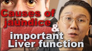 What Causes Yellowing of the Eyes Jaundice and Liver Function Explained  part 1 [upl. by Uni612]