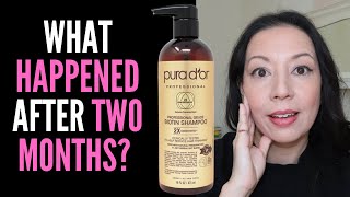 HAIR LOSS SUFFERER TESTS PURA DOR PROFESSIONAL BIOTIN SHAMPOO 8 WEEK REVIEW WITH BEFORE AND AFTER [upl. by Ruttger741]