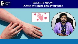 Monkeypox rash on skin  MPox Symptoms amp Diagnosis Mpox PhasesDrLeela Mohan P V RDoctors Circle [upl. by Namyw]