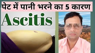 पेट में पानी भरने का 5 कारण Ascitis causes symptom cause of Ascitis [upl. by Jason869]