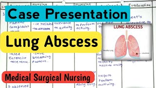 Case Presentation Nursing Care Plan Case study on Lung Abscess nursingcriteria [upl. by Lemrac]