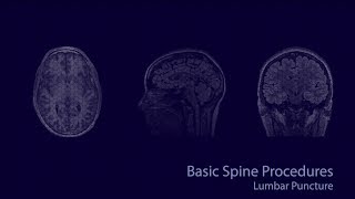 Basic neuroradiology procedures part 2  Lumbar puncture [upl. by Assirolc]