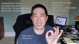 2 weeks after symfony lens Firsthand experience from ophthalmologist  Shannon Wong MD Vlog 15 [upl. by Aivataj]