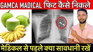 Gamca Medical Fit ॥Normal medical Fit मेडिकल फेल है।यह वीडियो पूरा ज़रूर देखें।gamca medical [upl. by Sofer98]