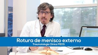 Rotura de menisco externo  Traumatología Clínica MEDS [upl. by Shandeigh504]