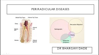 Periradicular DiseasesINBDEBDSMDS [upl. by Andree]