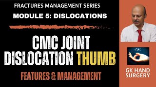 Thumb carpometacarpal joint dislocation CMC joint  Features and management [upl. by Aika113]