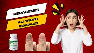 KERAGENIS KERAGENIS REVIEW ⚠❌☢ ALERT☢❌⚠ Keragenis Honest Reviews [upl. by Holmen]