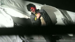 Chilling photos of Boston bombing suspect when captured [upl. by Alroy]