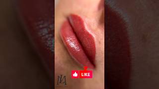 Lip Lift Surgical Markings  Dr Gary Linkov [upl. by Lipfert]