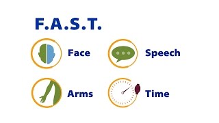 Recognize the Signs and Symptoms of Stroke [upl. by June856]