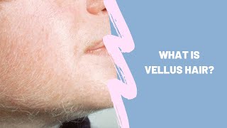 What is vellus hair [upl. by Mosora220]