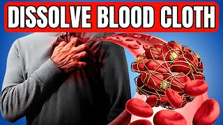 TOP 6 Vitamins To DISSOLVE Your BLOOD CLOTS [upl. by Haraj]