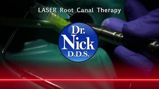 ROOT CANALS Using LASERS Are BETTER [upl. by Cerf]