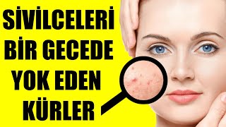 SİVİLCELERİ BİR GECEDE YOK EDEN KÜRLER [upl. by Ennaeirb533]