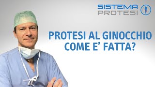 Protesi al ginocchio come è fatta gonartrosi [upl. by Henning]