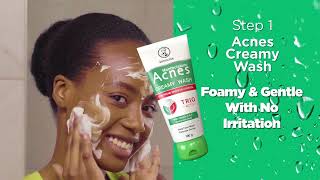 ACNES KENYA  Quickly Clears Pimples [upl. by Traggat283]