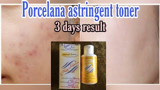 PORCELANA astringent tonerFast review3 to 5 days result sulit and effective [upl. by Alleyn870]