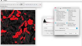 FIJI for Quantification Area of Stain [upl. by Akiemahs]