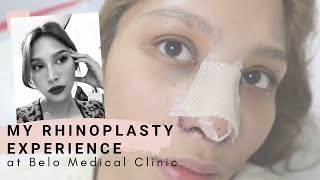 My Nose Job Rhinoplasty Experience at Belo Medical Group Philippines  Denise Botor [upl. by Tessil]