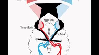 Visual pathway and visual field defects [upl. by Irmgard]