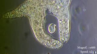 Amoeba eats paramecia  Amoebas lunch   Amoeba Endocytosis  Phagocytosis Part 1  👌 [upl. by Eanom]