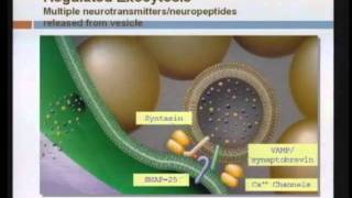 Spasticity Management [upl. by Aetnahs]