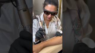 Pico Laser Treatment For Sun Tan Removal  Benefits Of Pico Laser Treatment [upl. by Eilzel]