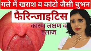 गले में सूजन  pharyngitis throat infection treatment in hindi  home remedies for sore throat [upl. by Small]