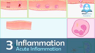 Acute Inflammation  Vascular amp Cellular Events [upl. by Aztiley]