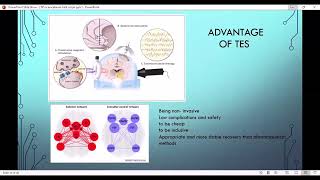 TES Webinar [upl. by Adonis]